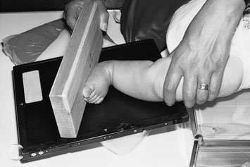 Figura 6: Aspect radiografic / Poziționare (Clark Ed. 12)