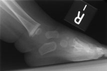 Figura 7: Aspect radiografic / Poziționare (Clark Ed. 12)