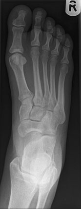 Figura 3: Aspect radiografic / Poziționare (Clark Ed. 12)