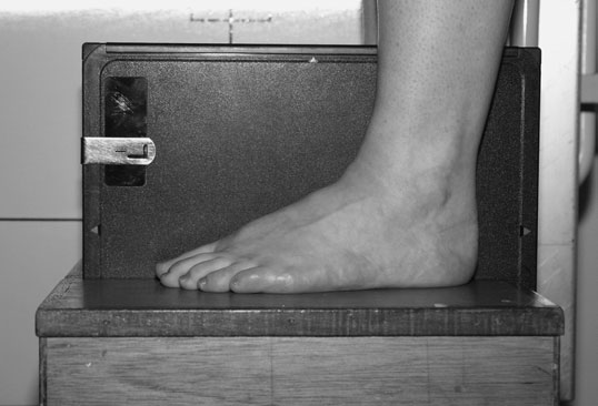 Incidență dorsoplantară în ortostatism a ambelor picioare, evidențiind hallux valgus