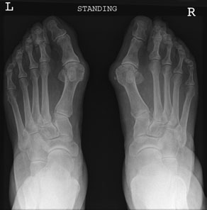 Figura 4: Aspect radiografic / Poziționare (Clark Ed. 12)