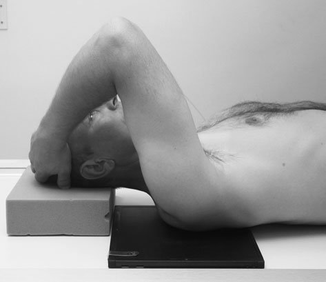 Radiografie normală anteroposterioară (AP) a procesului coracoid