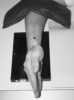 radiografie a Pumnului (Articulației Radiocarpiene)