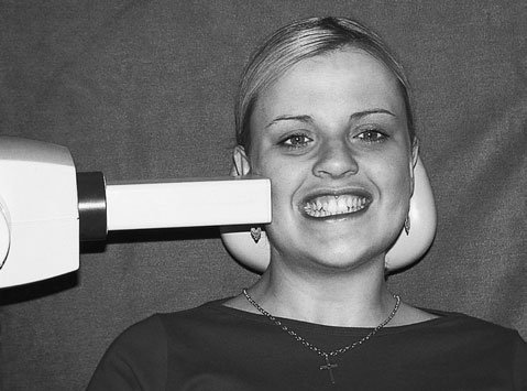 Radiografie utilizând o clapetă bitewing