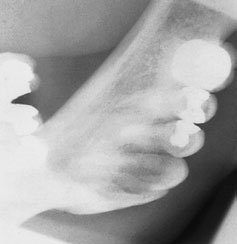 Radiografie dentară ocluzală
