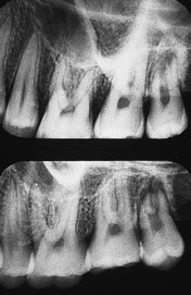 Figura 8: Aspect radiografic / Poziționare (Clark Ed. 12)