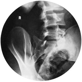 Figura 3: Aspect radiografic / Poziționare (Clark Ed. 12)