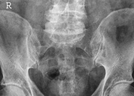 Figura 2: Aspect radiografic / Poziționare (Clark Ed. 12)