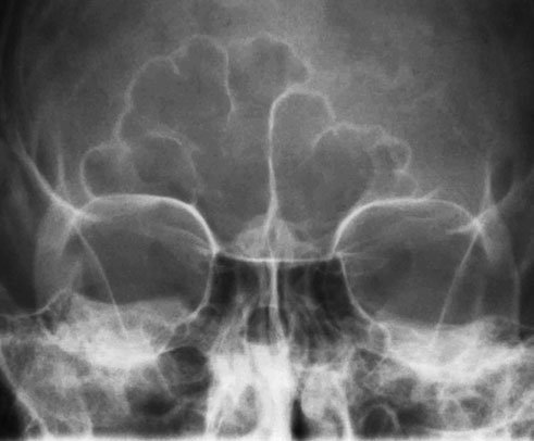 Figura 2: Aspect radiografic / Poziționare (Clark Ed. 12)