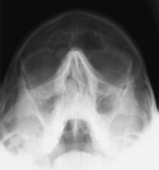 Figura 3: Aspect radiografic / Poziționare (Clark Ed. 12)