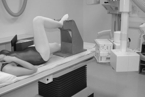 Pacienți cu suspiciune clinică de fractură (piciorul afectat în