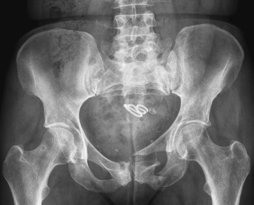 • La prima vizită la clinică și în cazurile de traumatism, este o practică nor- [fragment deteriorat în sursă]