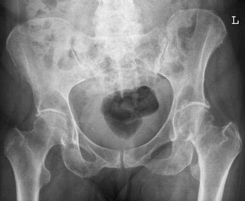 repetare inutilă a radiografiei.