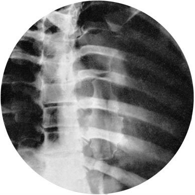 Figura 2: Aspect radiografic / Poziționare (Clark Ed. 12)