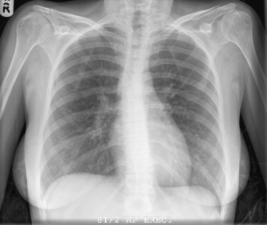• Radiografia alăturată are un aspect similar cu cea de [fragment incomplet în sursă].