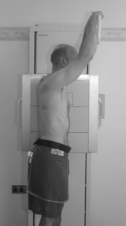 Incidență postero-anterioară (PA). Radiografiile de profil, însă, sunt [fragment incomplet în sursă].