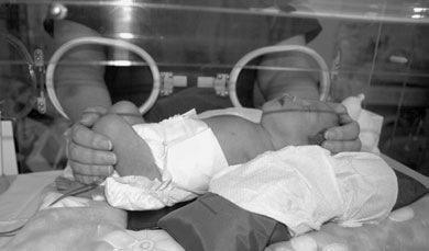 • ca în cazul tuturor radiografiilor, dar în special în activitatea neonatală, unde