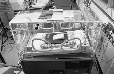 • Efectuarea radiografiei când sugarul plânge trebuie evitată,