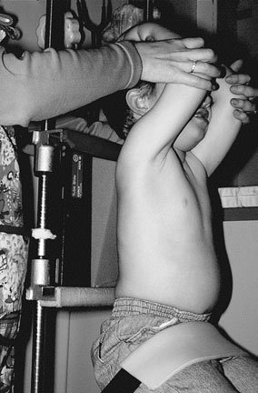 Poziția copilului pentru radiografia toracică antero-posterioară (AP)