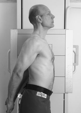 Radiografie de profil (lateral) evidențiind normal