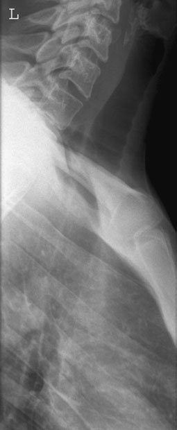 Figura 6: Aspect radiografic / Poziționare (Clark Ed. 12)