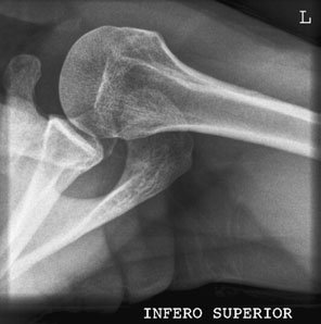 Figura 4: Aspect radiografic / Poziționare (Clark Ed. 12)