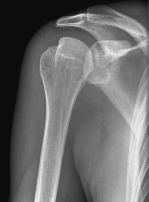 Figura 3: Aspect radiografic / Poziționare (Clark Ed. 12)