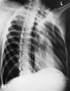 Figura 4: Aspect radiografic / Poziționare (Clark Ed. 12)