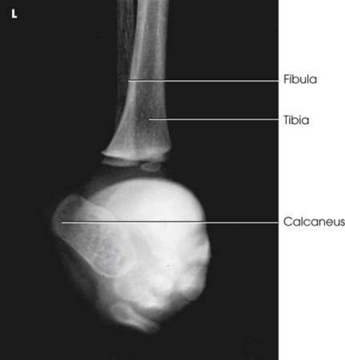 Merrill — pagina 500, imaginea 2