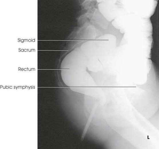 Merrill — pagina 1168, imaginea 2