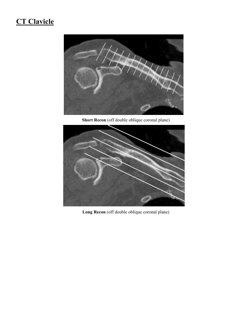 Claviculă — pagina 4