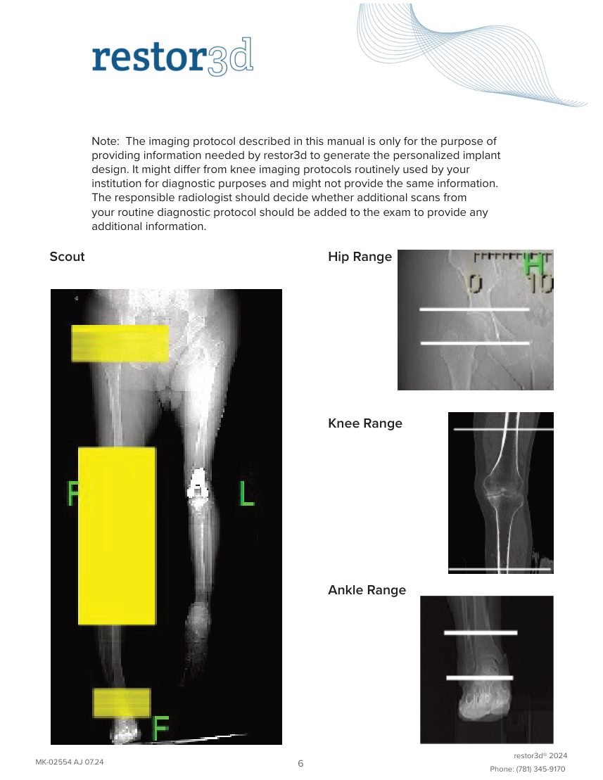 Genunchi Restor3D Conformis — pagina 10