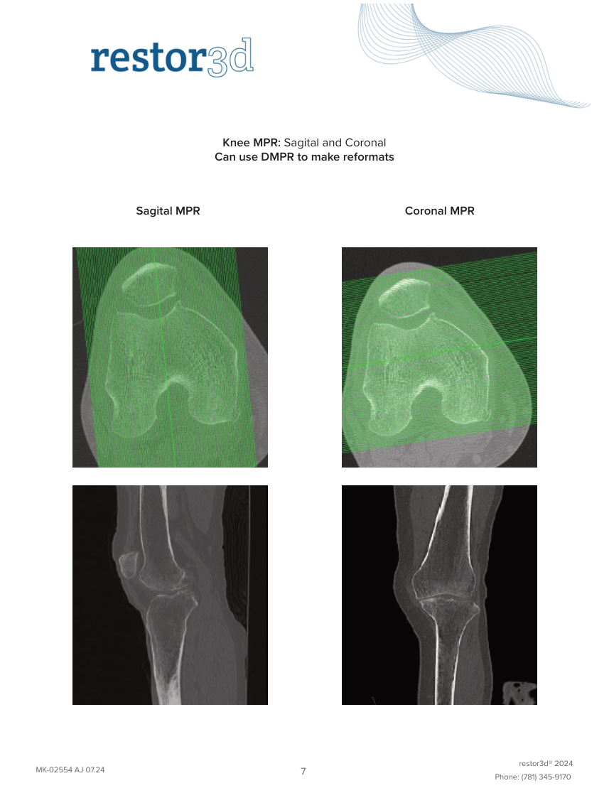 Genunchi Restor3D Conformis — pagina 11