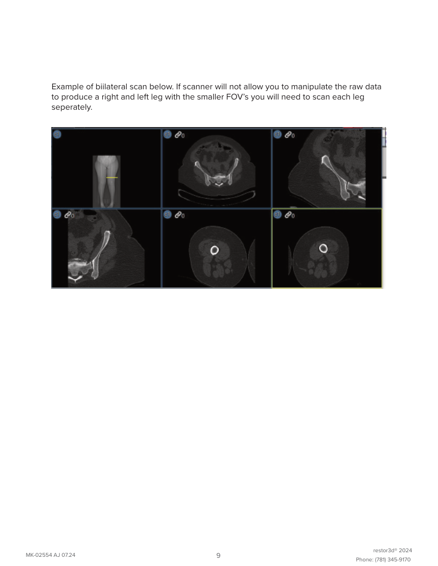 Genunchi Restor3D Conformis — pagina 13