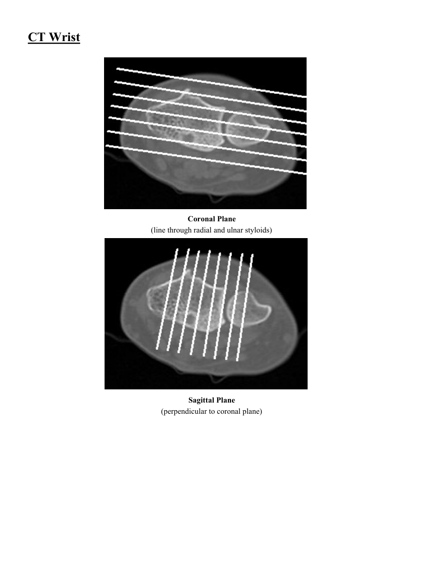 Pumn — pagina 3