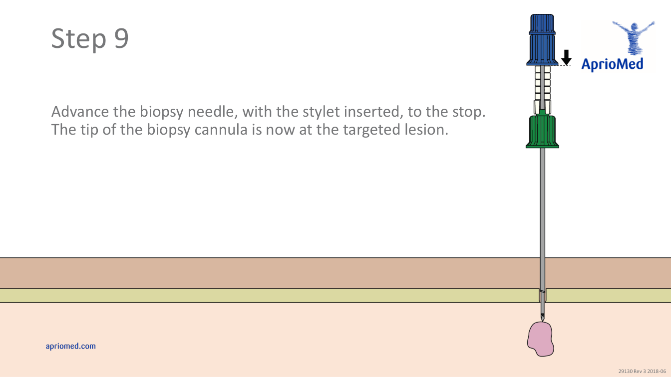 Utilizarea sistemului de biopsie Bonopty — pagina 10