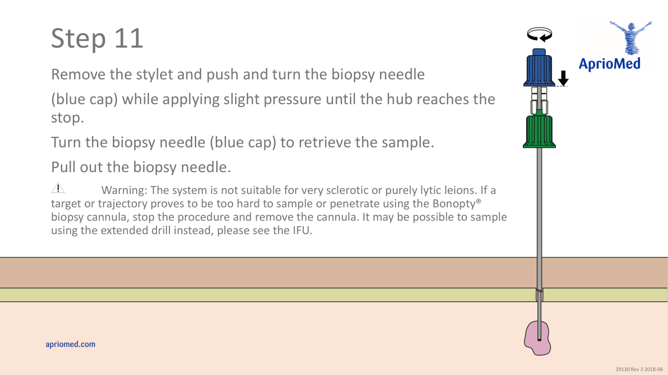 Utilizarea sistemului de biopsie Bonopty — pagina 12