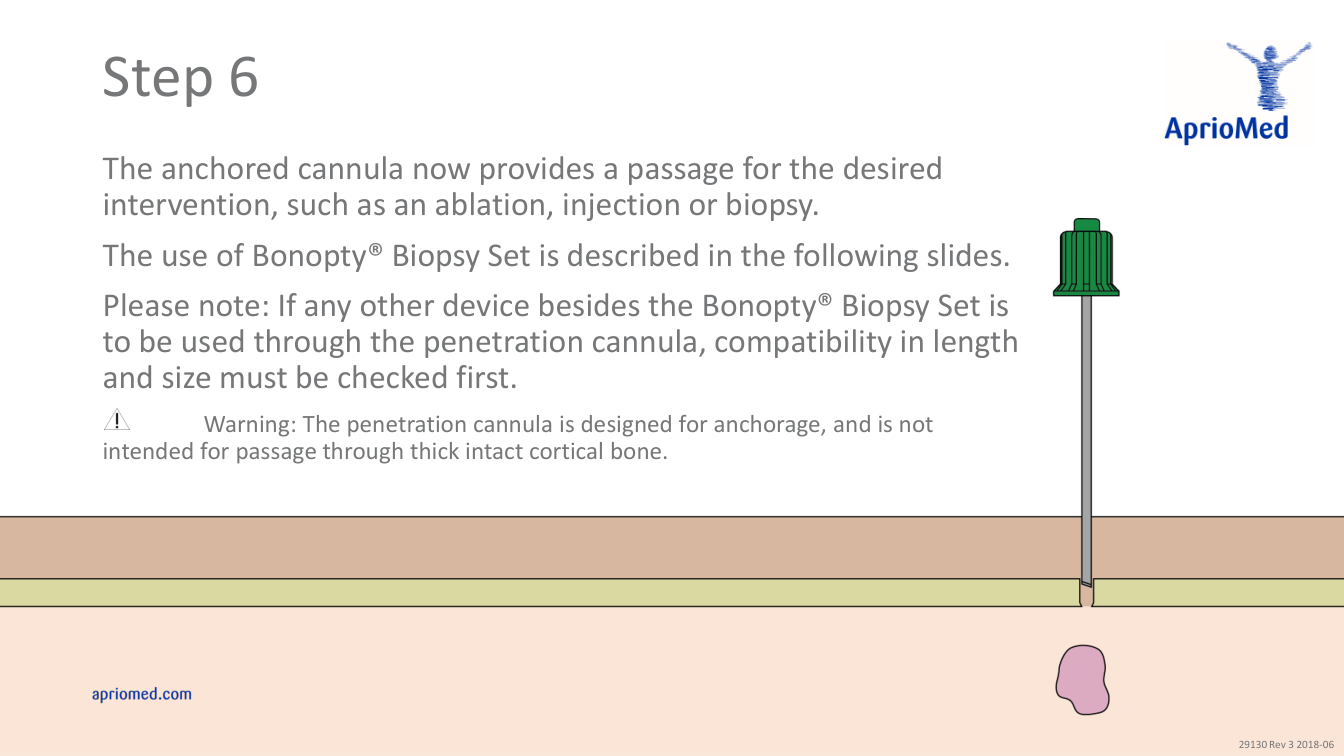 Utilizarea sistemului de biopsie Bonopty — pagina 7
