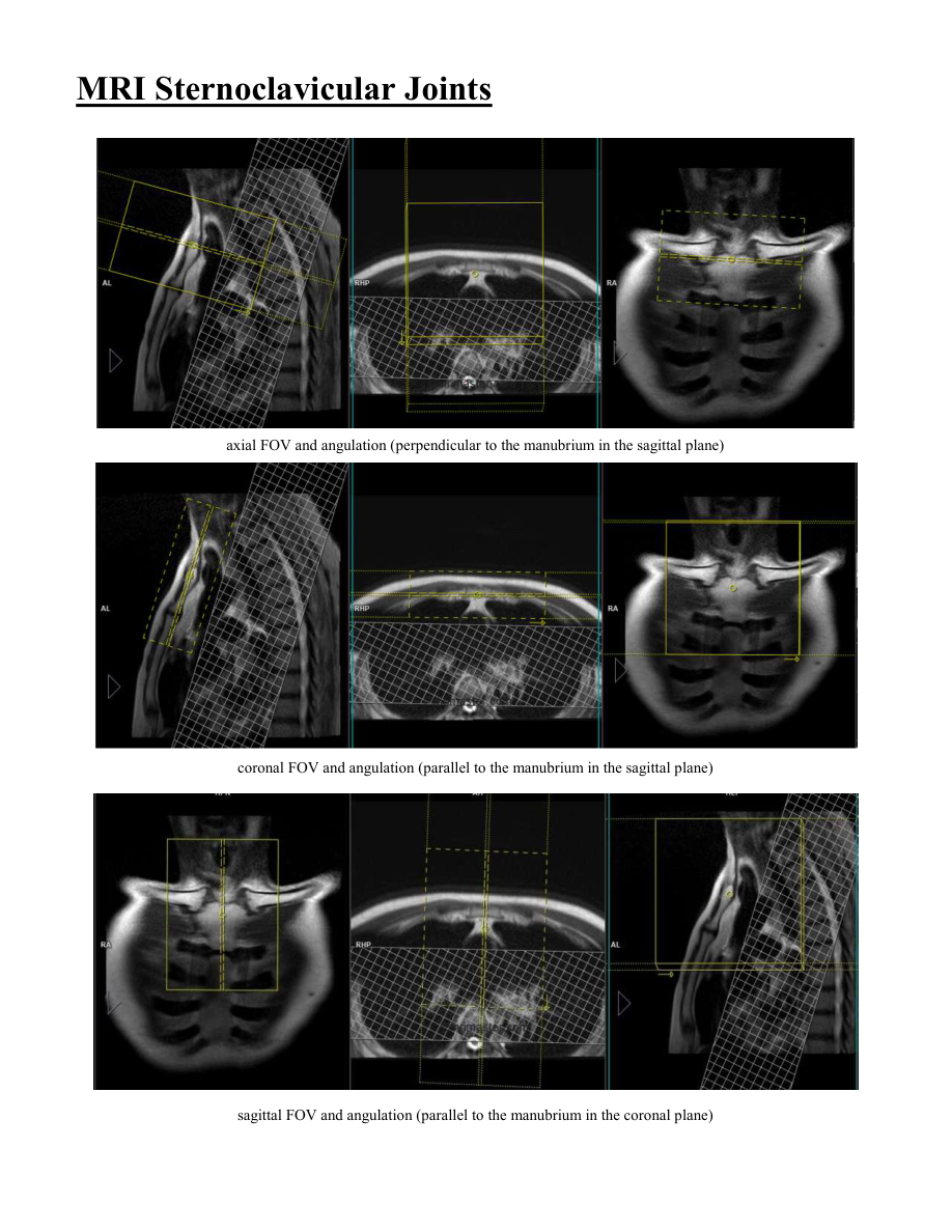 Articulații sternoclaviculare — pagina 2
