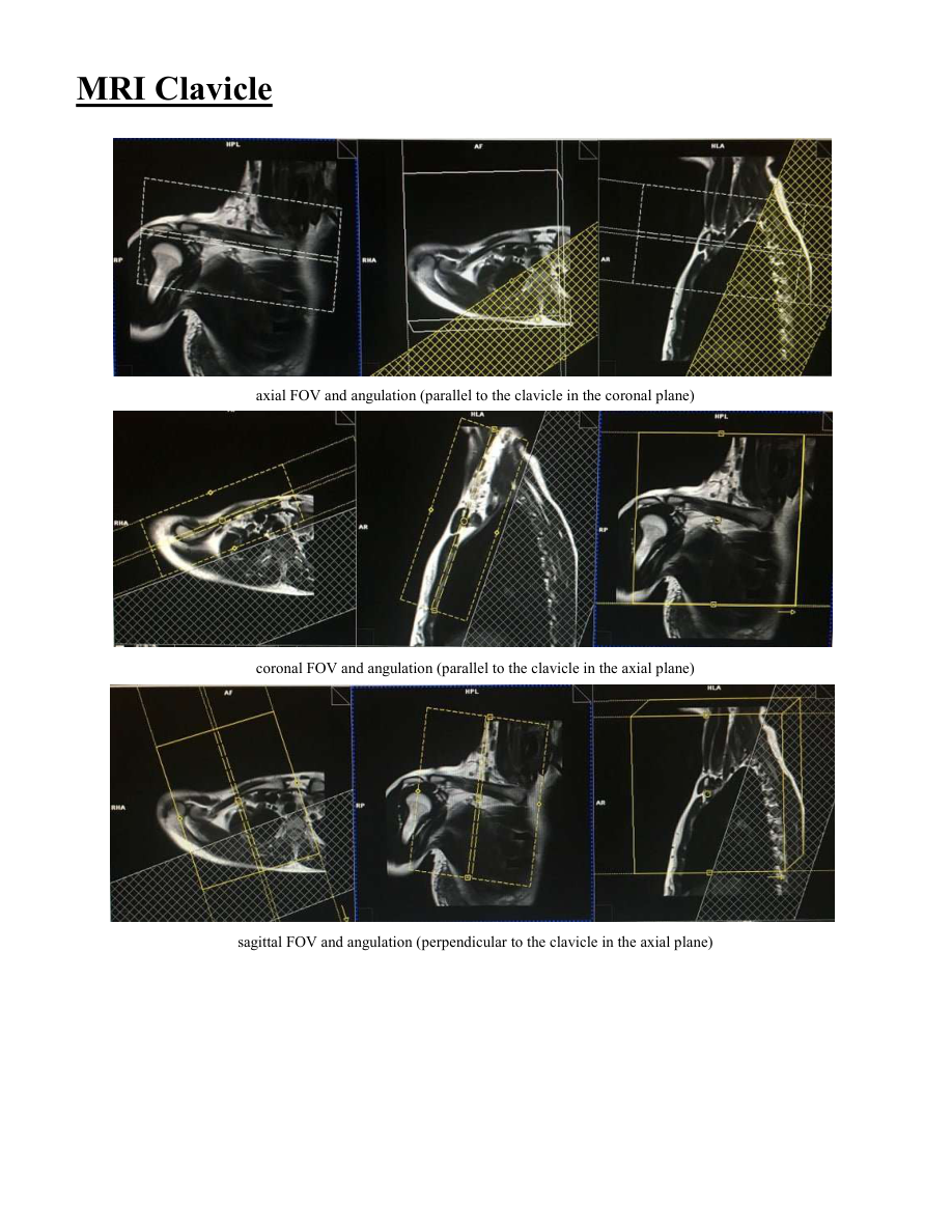 Claviculă — pagina 2
