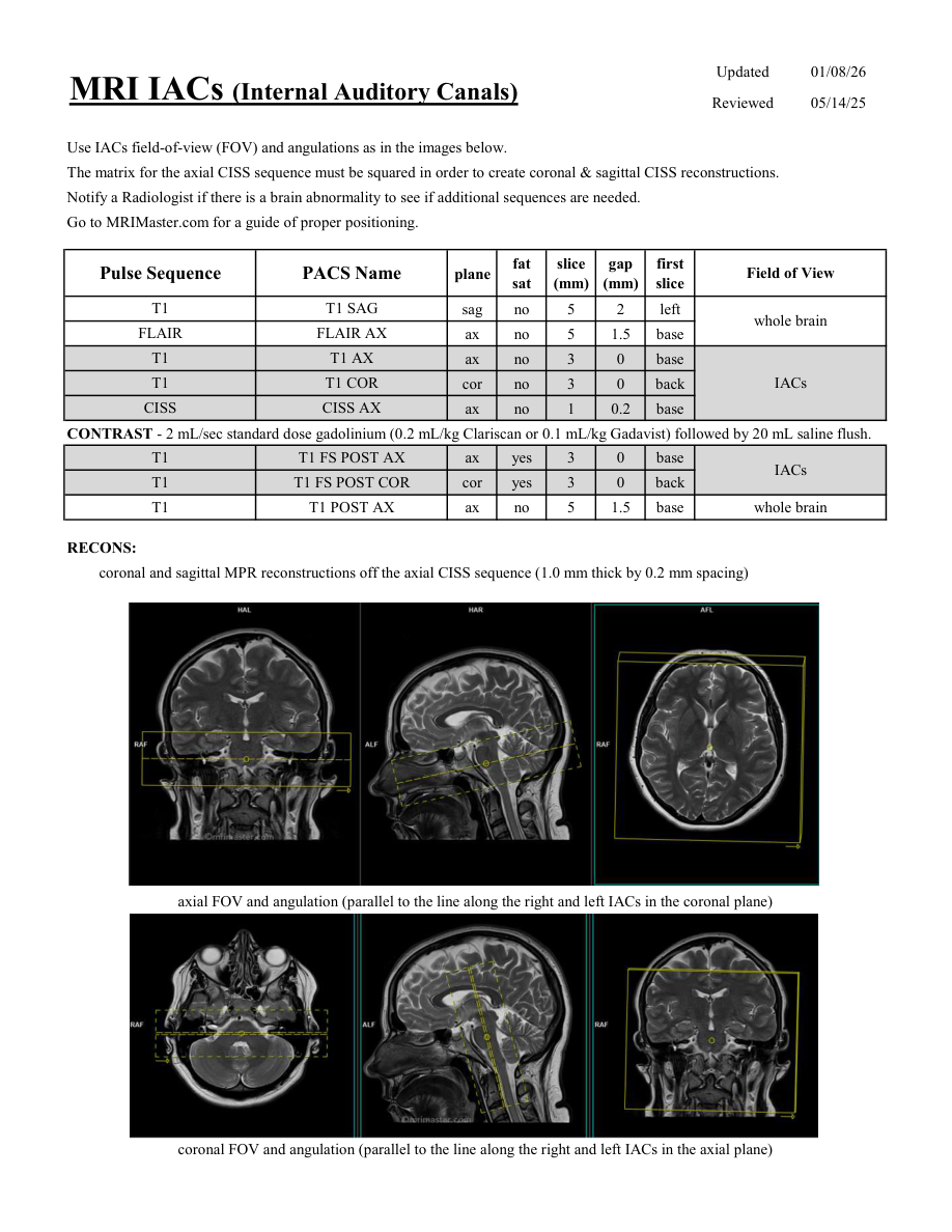 Conducte auditive interne (IAC) — pagina 1