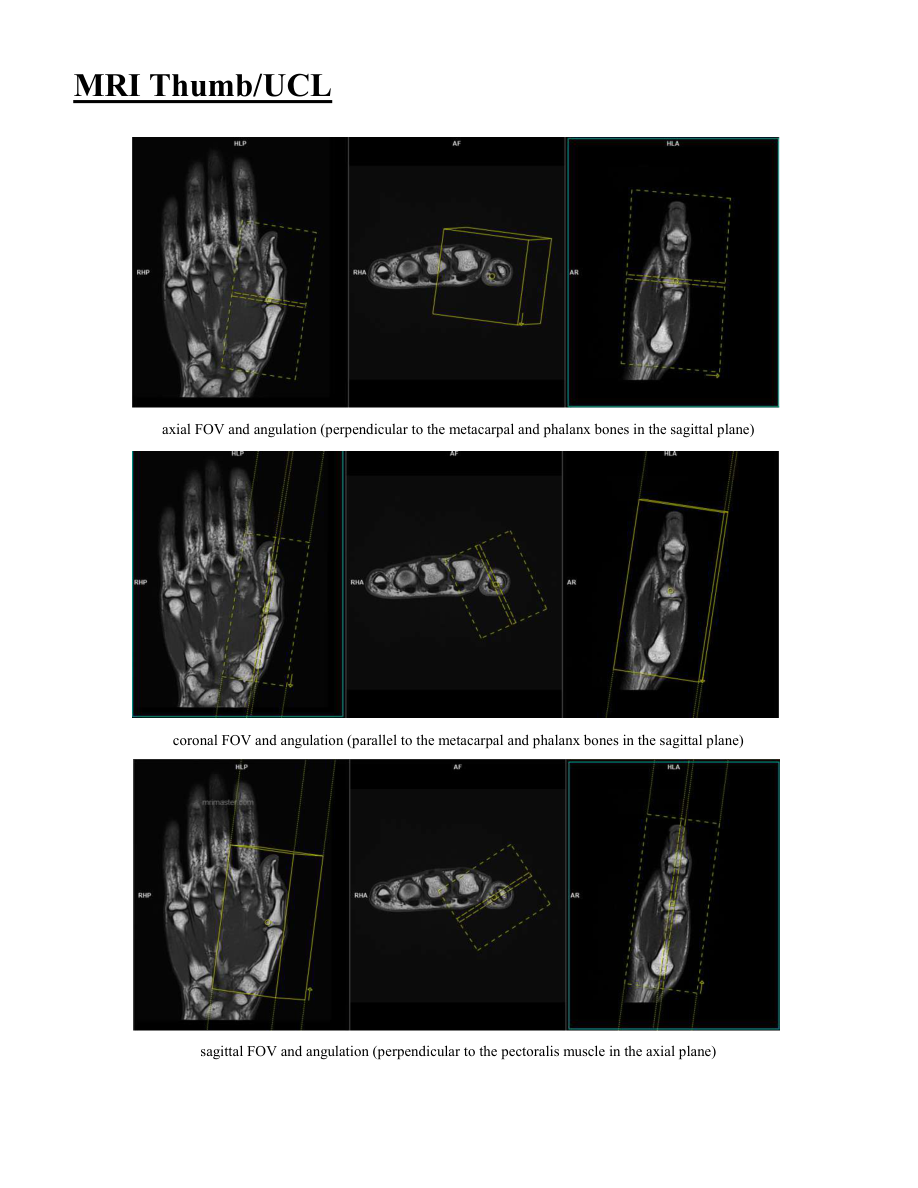 Police și ligament colateral ulnar — pagina 2