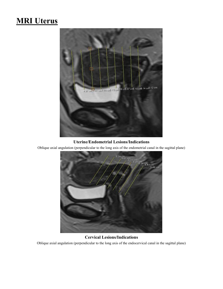 Uter — pagina 2