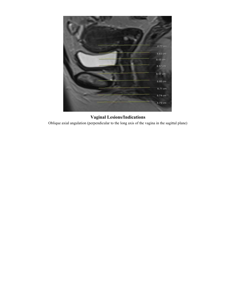Uter — pagina 3